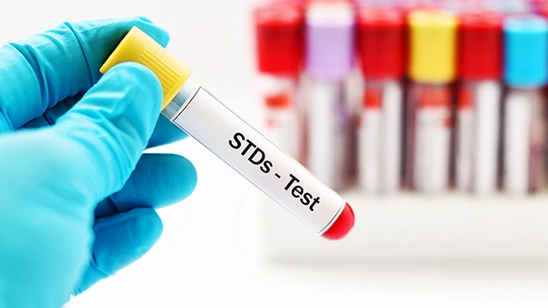 Rapid Std Testing Houston