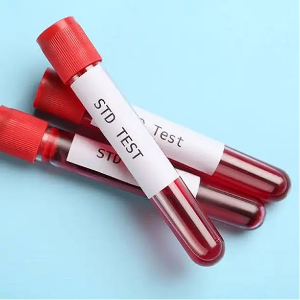 STD Test And Treatment in Conroe Montgomery TX