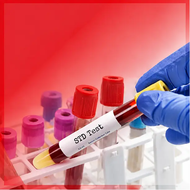 STD Test & Treatment in Spring, TX