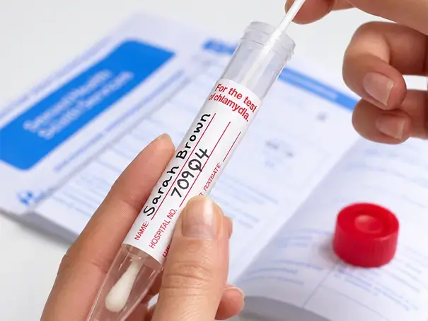 STD Treatment in Kingwood TX