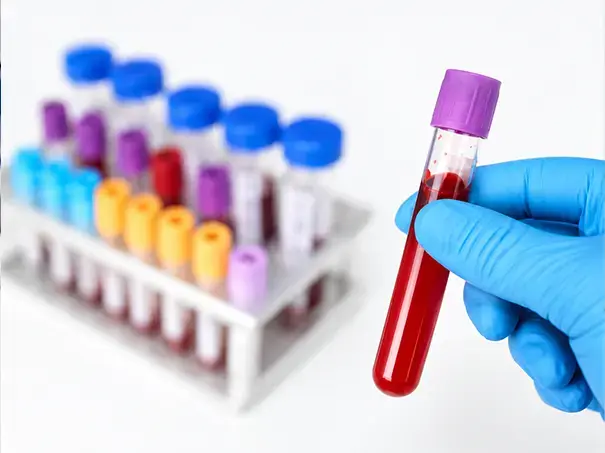 Gloved hand holding a purple-capped blood sample tube at a clinic in Richmond/Rosenberg, Texas.