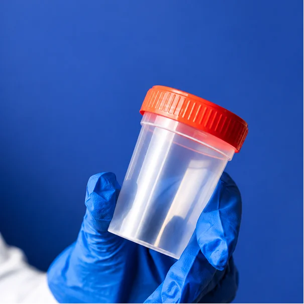 Who Should Get a Gonorrhea Testing